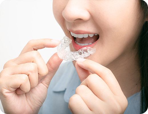 インビザラインファーストとは